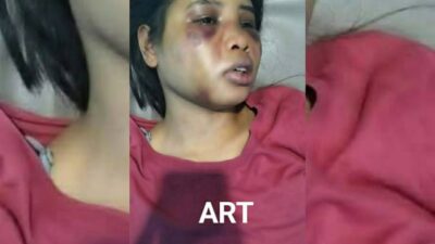 Disiksa Majikan Setahun, ART di Batam Dipaksa Makan Kotoran Anjing dan Minum Air Parit