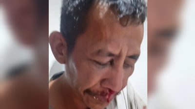 Kodat 86 Bakal Lapor ke Purbaya Soal Petugas Bea Cukai Diduga Keroyok Sopir Lori di Batam