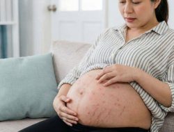 Waspada! 9 Penyakit Kulit Umum Saat Hamil