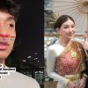 Frontal bela sang ayah, Betrand Peto kini minta maaf, berharap Sarwendah dan Ruben Onsu damai